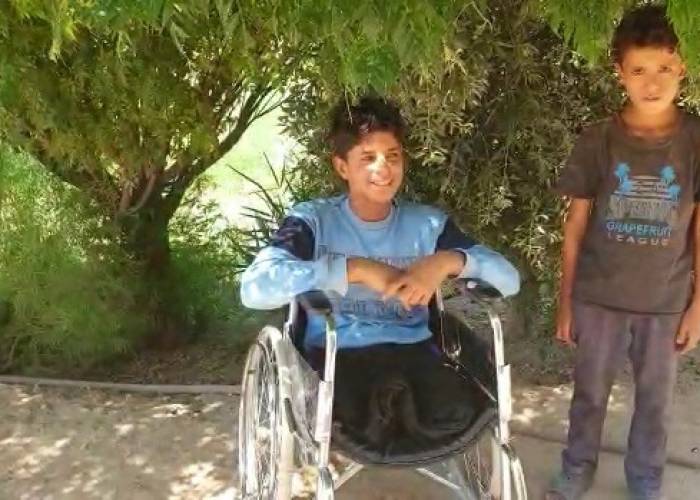 War amputee Mohamed seeks prosthetics to shorten stride to school